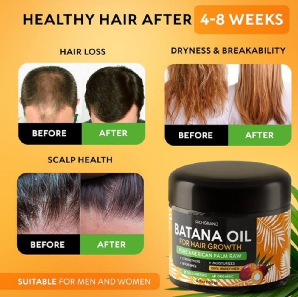 New Richgrand Batana Hair Growth,100% Raw Organic Pressed Oil